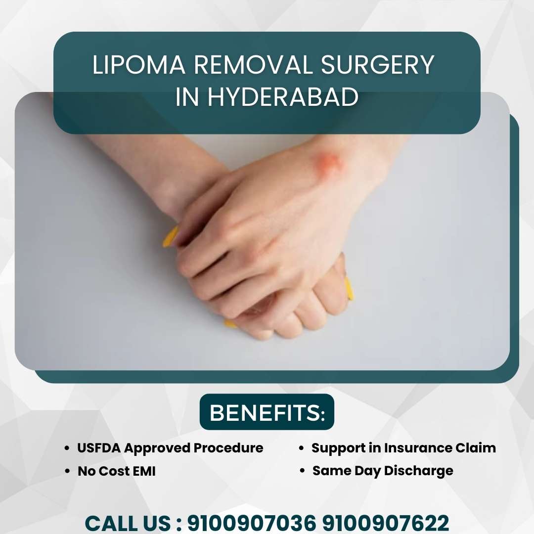 Lipoma Removal Surgery In Hyderabad Surgery Procedure