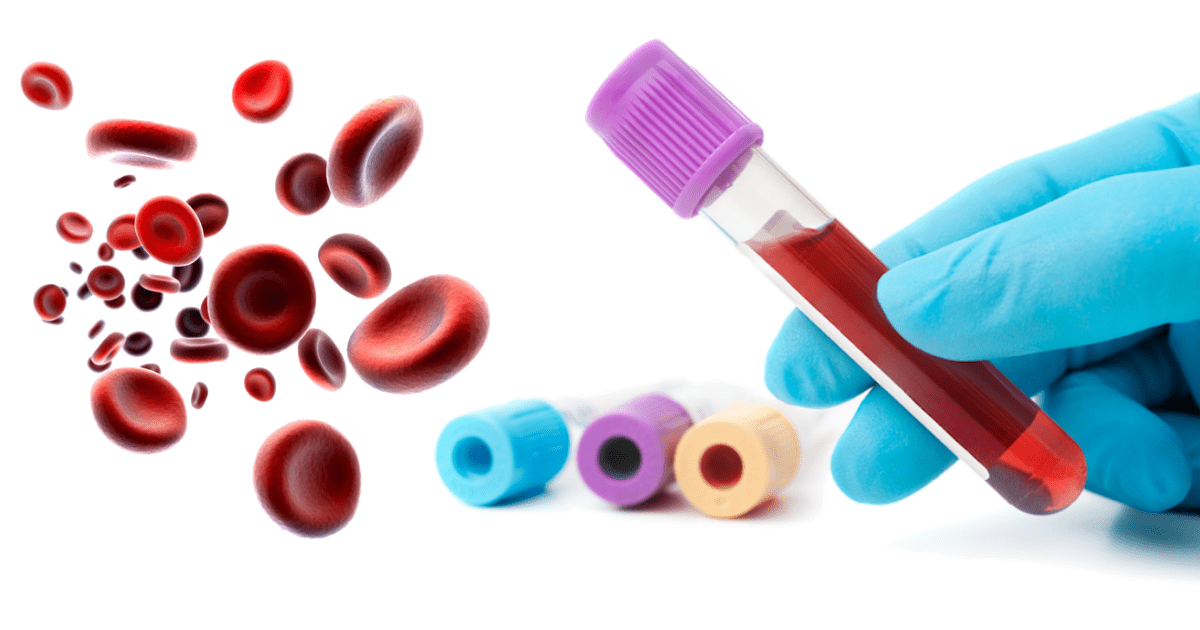 Iron Blood Test Tube Color at Mary Trice blog