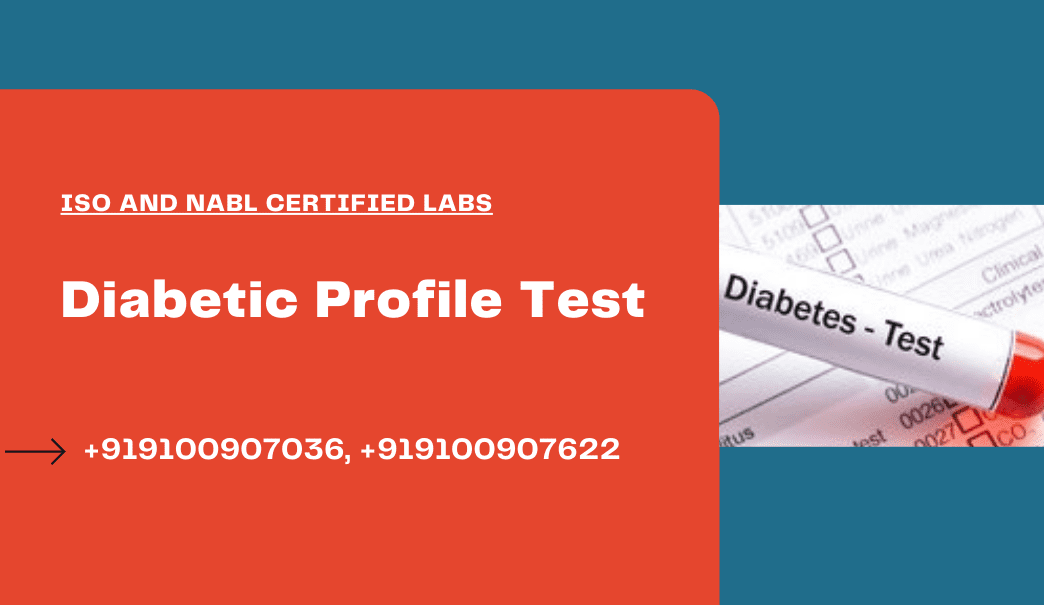 Diabetic profile test