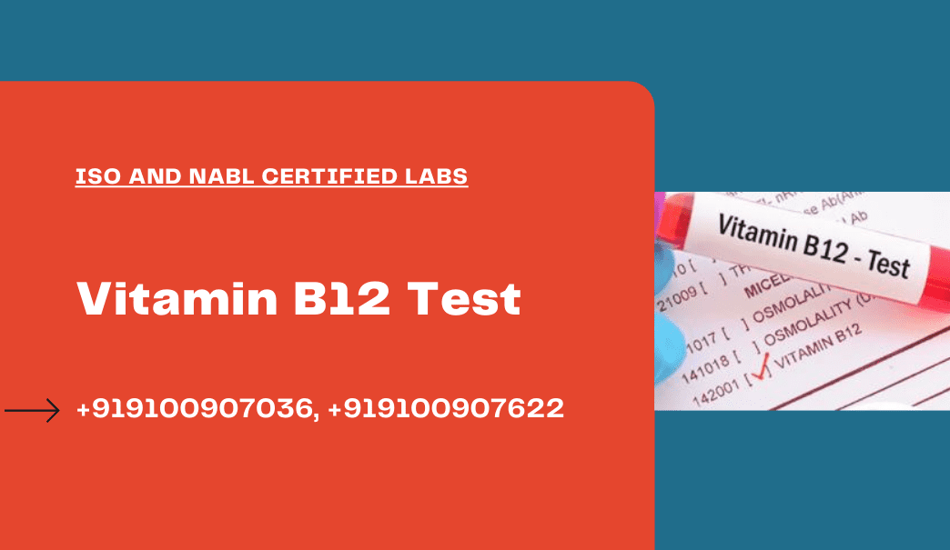 Vitamin B12 test in Hyderabad