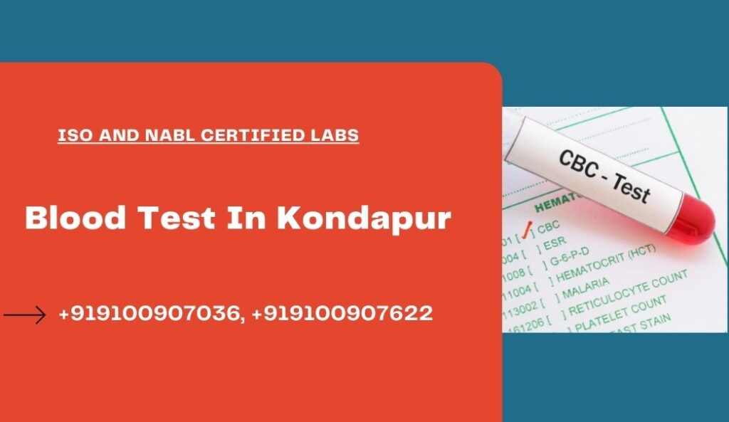 Blood test at home Kondapur