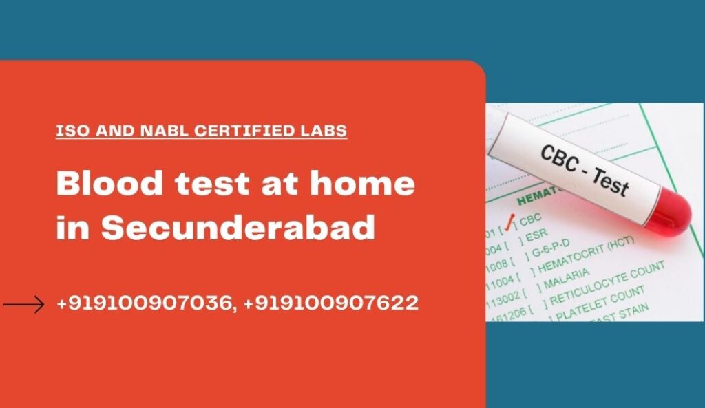 Blood test at home in Secunderabad