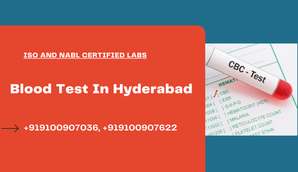 Blood test at home in hyderabd
