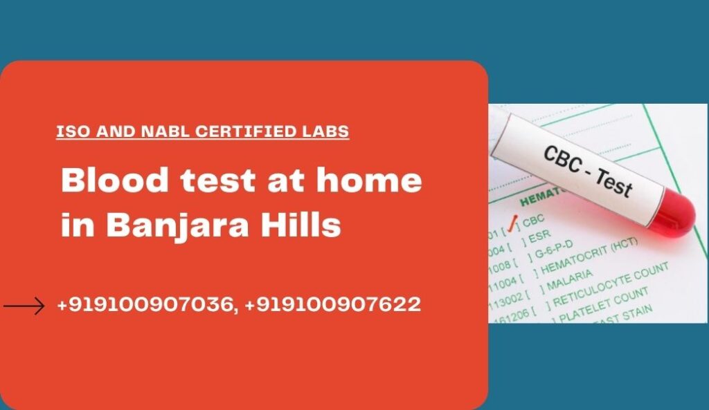 Blood Test at Home In Banjara Hills | blood sample collection| Medintu