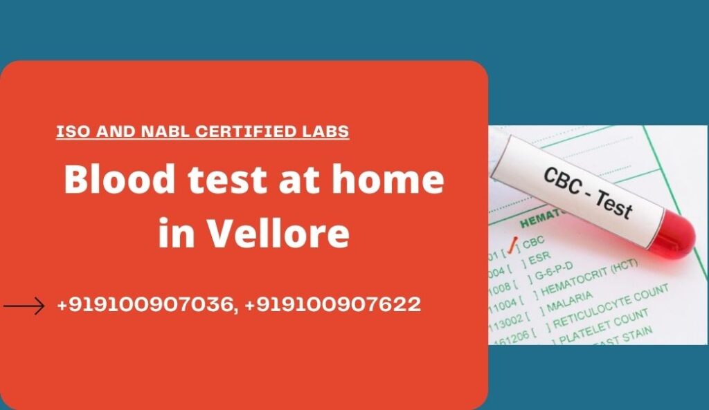 Blood test in Vellore