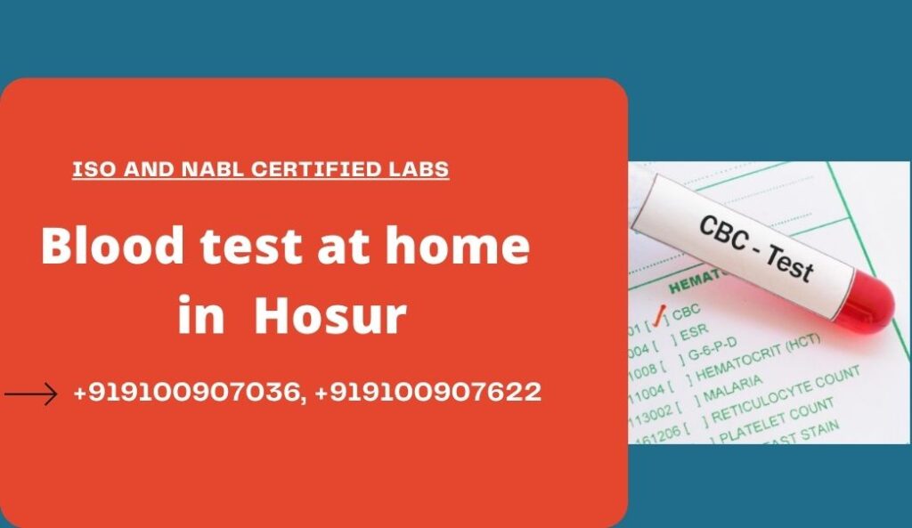 Blood Test At Home In Hosur