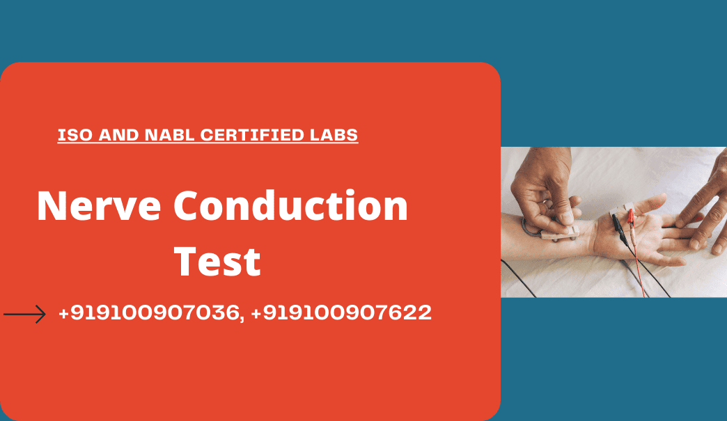 Nerve Conduction Test cost in Hyderabad