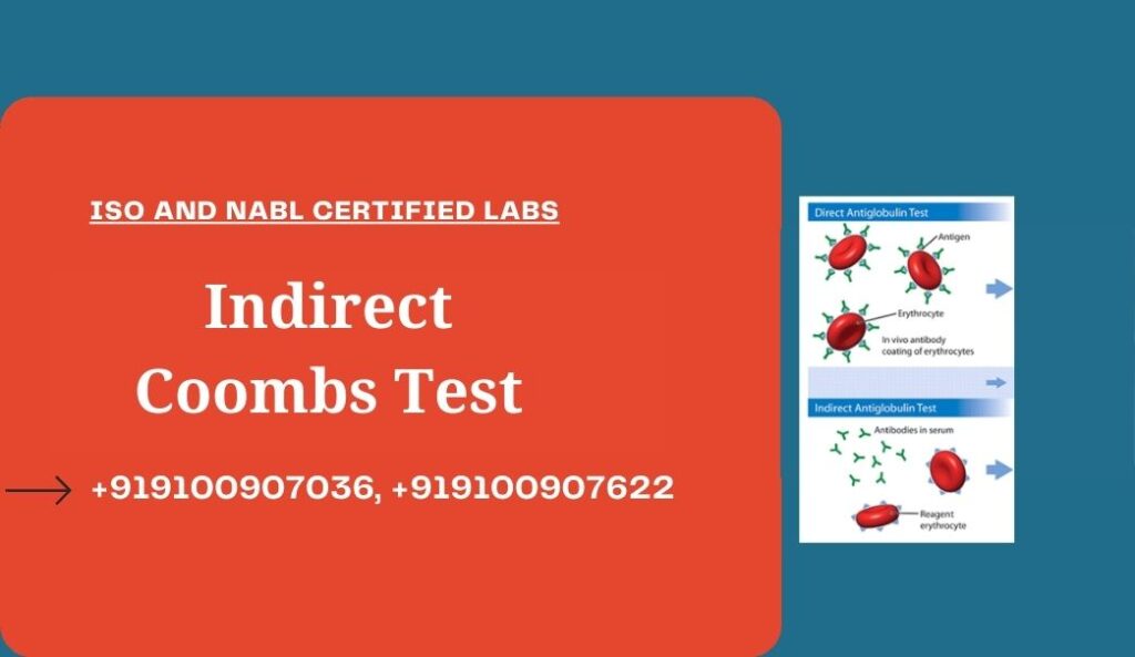 Indirect Coombs Test Cost In Hyderabad 149Rs Medintu