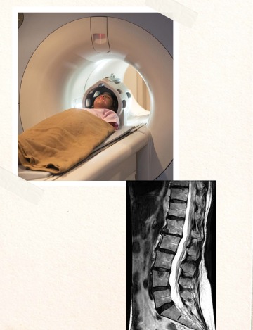 MRI scan for lumbar spine