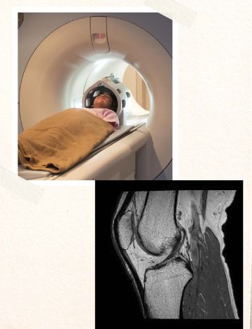 MRI for Knee joint in Hyderabad