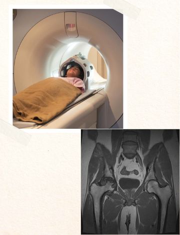 MRI scan for uterus