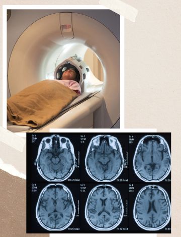 MRI scan for brain