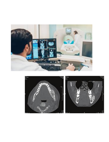 CT Scan Mandible