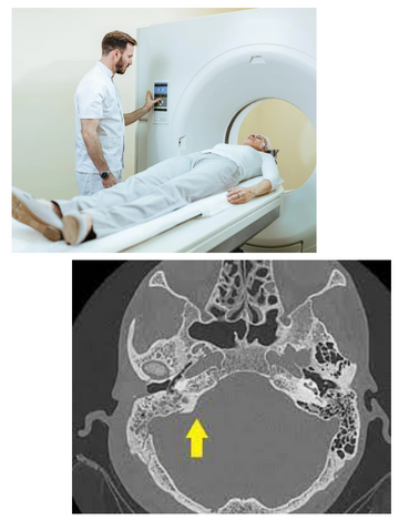 CT scan for mastoids in Hyderabad