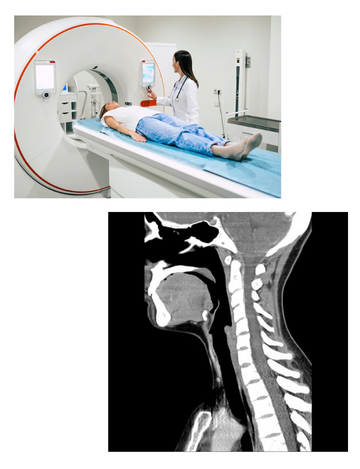 CT scan for neck in Hyderabad