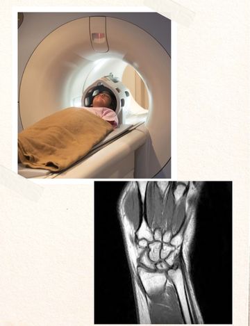 MRI WRIST