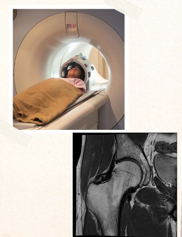MRI scan for hip joint
