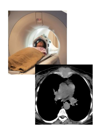 CT Scan for sternum