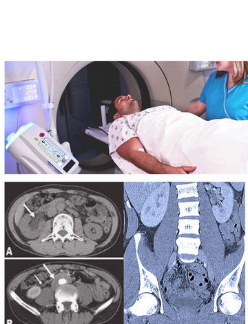 abdomen plain CT scan