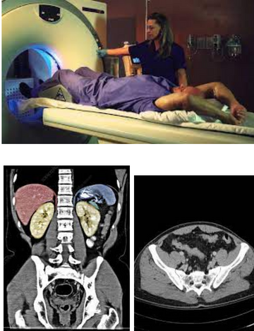 pelvis CT scan