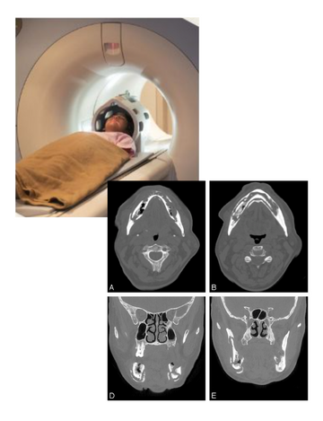 jaw ct