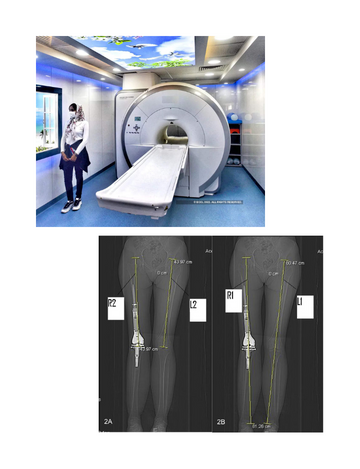 CT Scan For Scanogram Cost Medintu