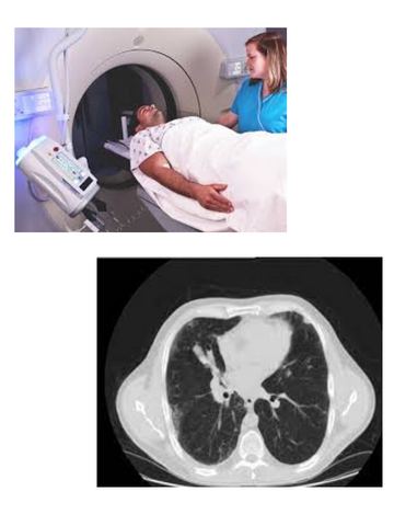 CT Scan for Thorax in Hyderabad