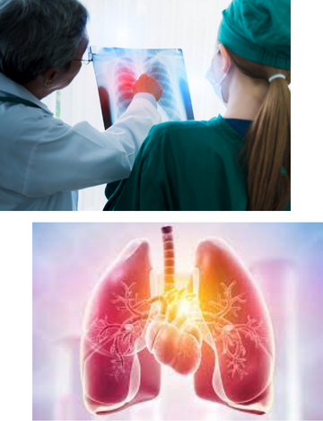 Pulmonary Angiogram