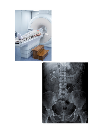 CT scan kub-plain