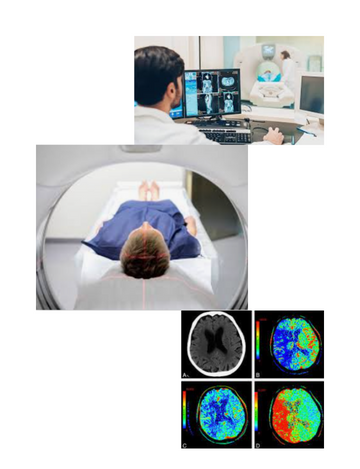 Brain with perfusion