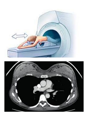 breast ct scan