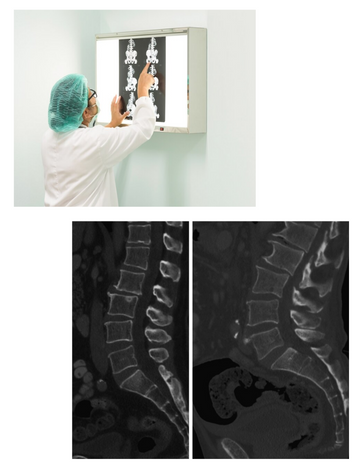 CT scan for sacrum in hyderabad