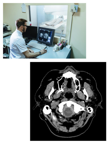 CT scan for sialography in hyderabad