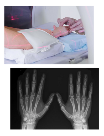 CT scan for hand in hyderabad