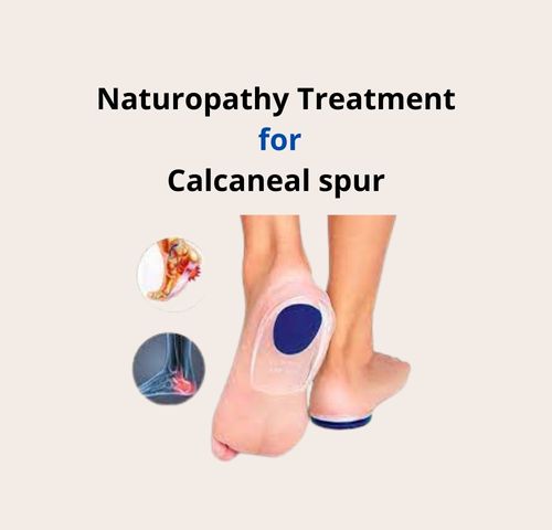 Calcaneal Spur Treatment Services at best price in New Delhi | ID:  18991501255