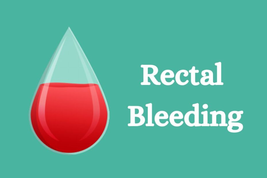 Rectal Bleeding Symptomscauses And Treatment 