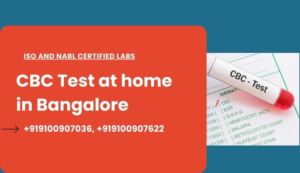 Cbc test at home in bangalore
