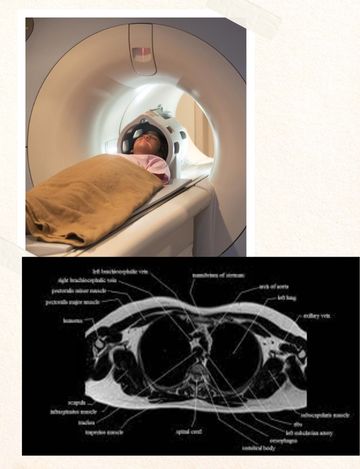 MRI Scan for Thorax