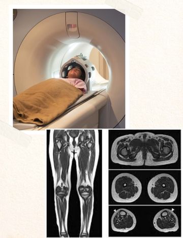 mri lower limb