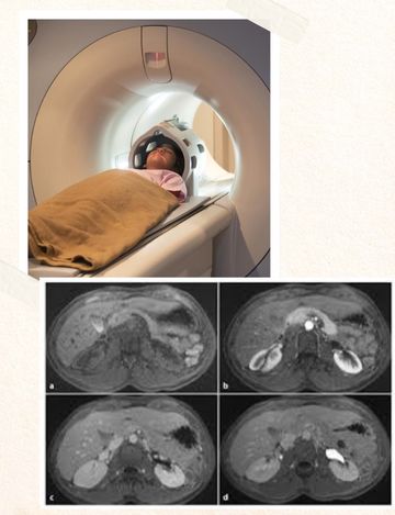 MRCP Test scan in Hyderabad