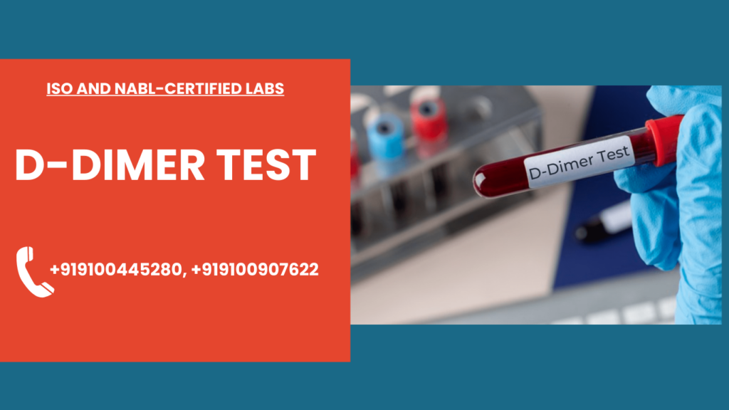 D-Dimer test