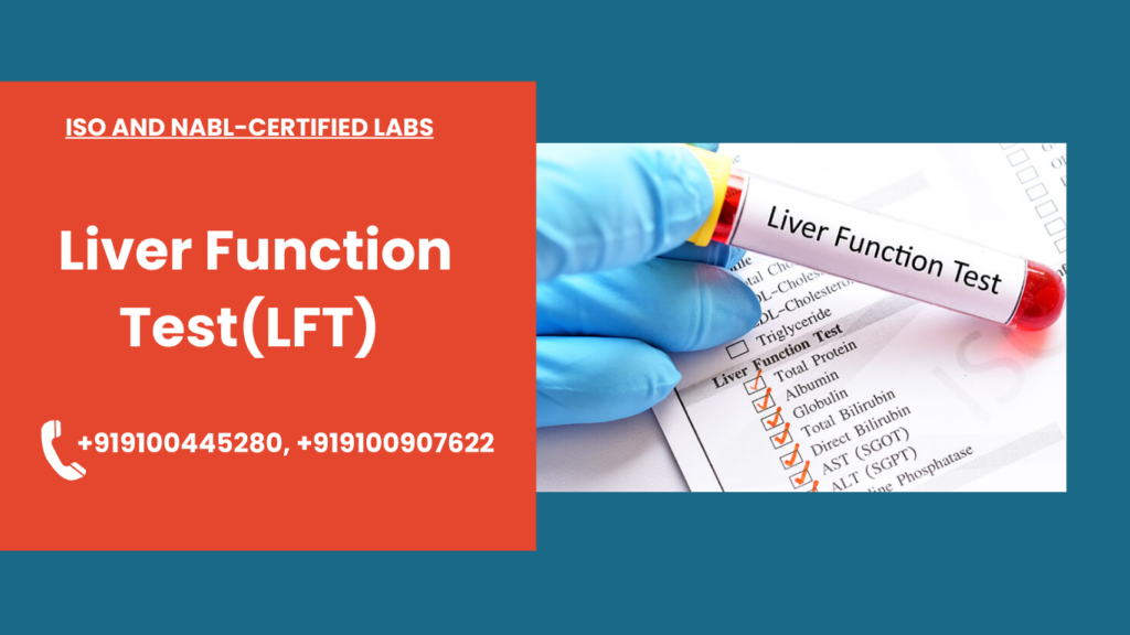 Liver Function Test(LFT)