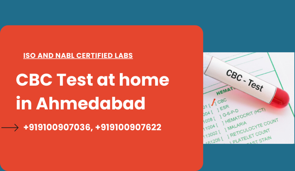 CBC Test Price in Ahmedabad