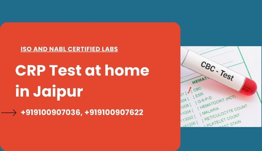 CRP Test at Home in Bangalore