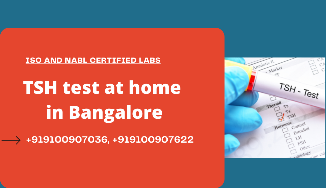 tsh-test-cost-in-bangalore-rs-199-medintu