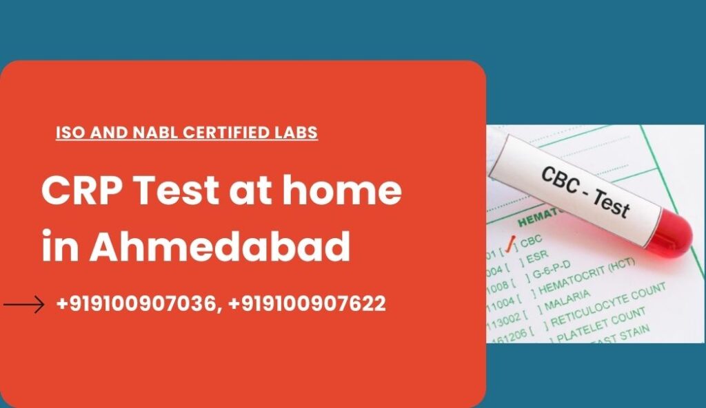 CRP Test at Home in Ahmedabad