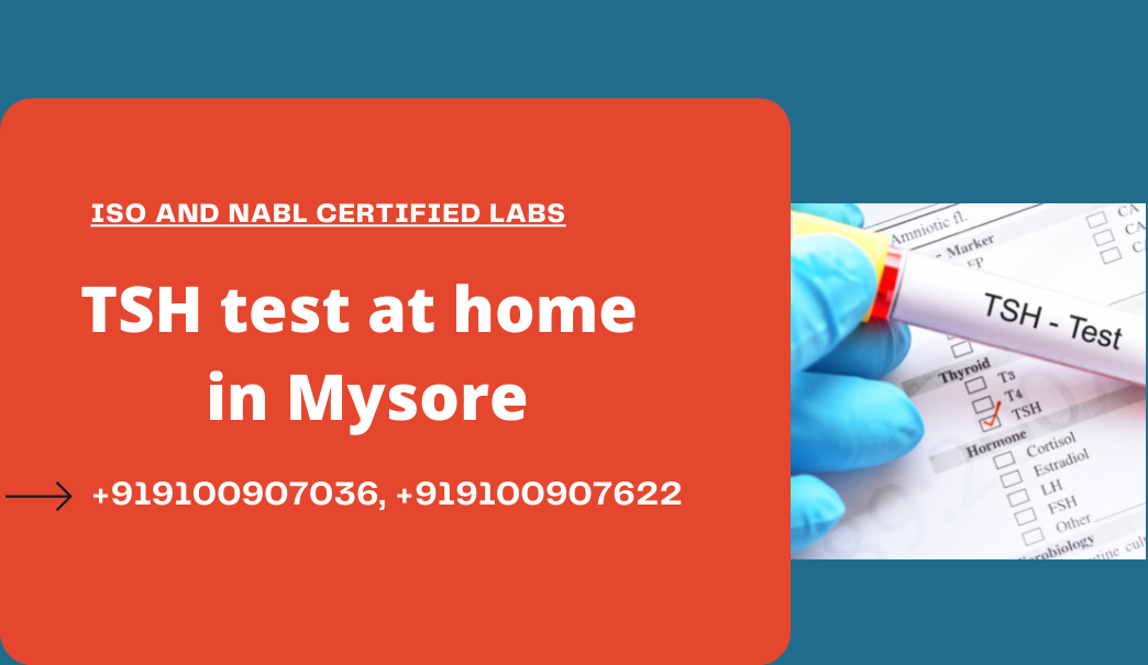 tsh test cost in mysore