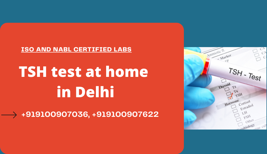 TSH Test cost in Delhi