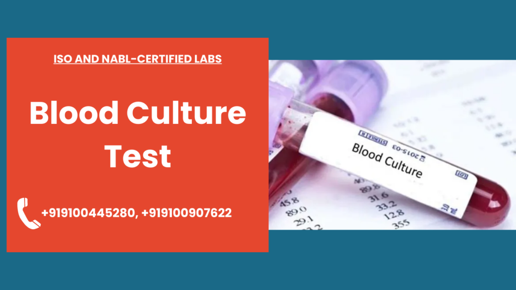 Blood Culture Test