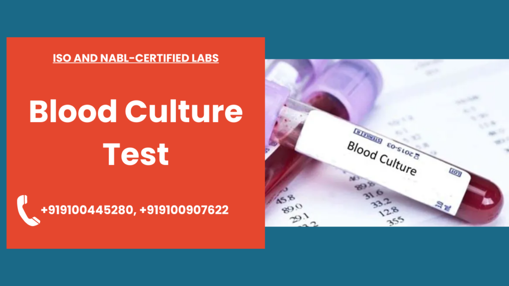 What Can Blood Culture Test Show